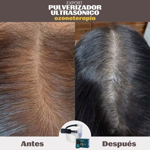 PACK Pulverizador Ultrasónico O y ONE