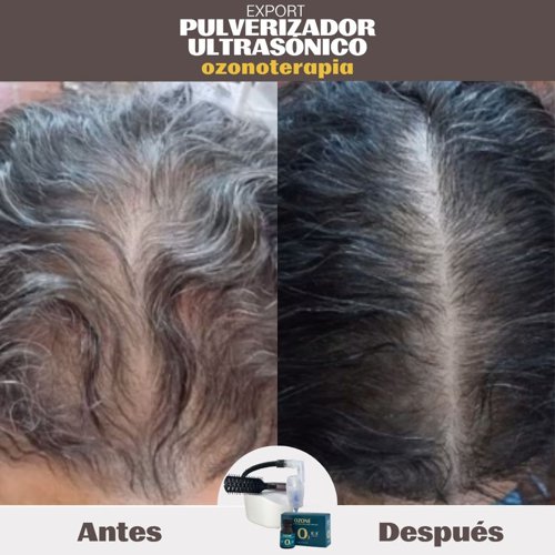 PACK Pulverizador Ultrasónico O y ONE