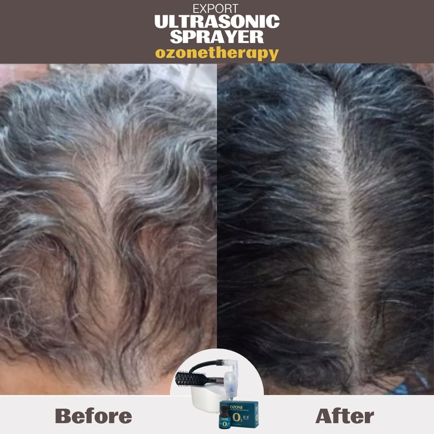 Ampolla Export Cacau Ozono